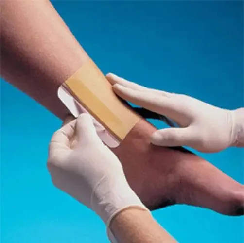 Advanced Wound Dressings